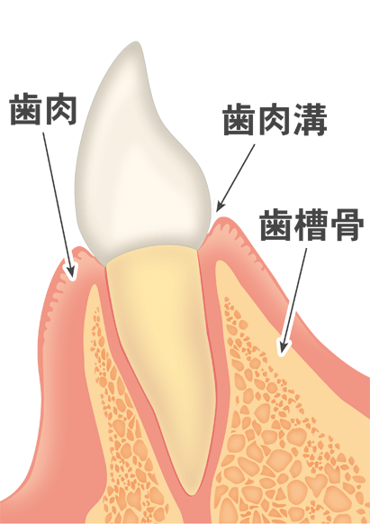 歯周病の進行と治療法